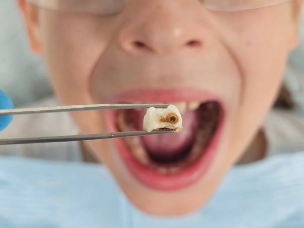 Best Dentist for Severe Toothache  in Mandeville, LA